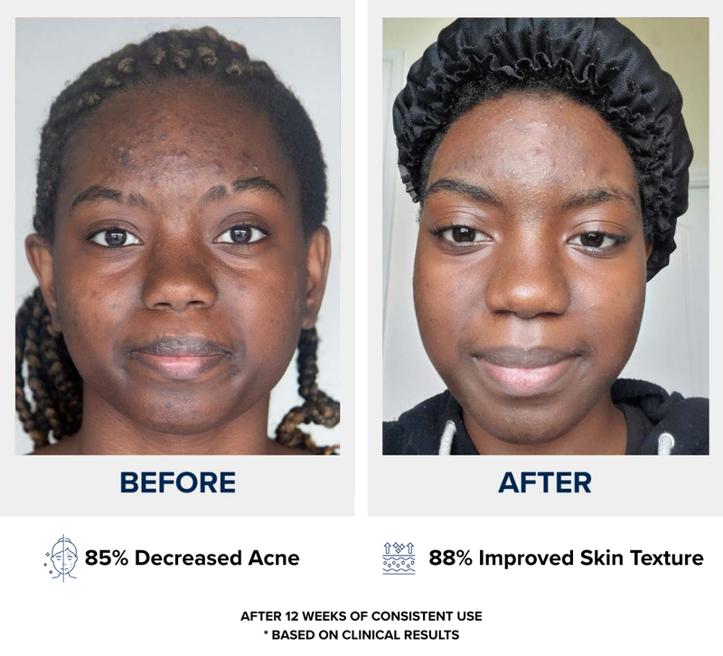 N1O1 nitric oxide nitric oxide nitric oxide signaling molecule