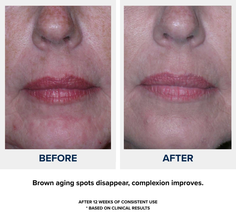 N1O1 nitric oxide nitric oxide nitric oxide signaling molecule