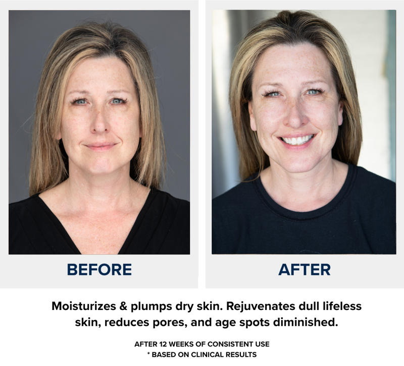 N1O1 nitric oxide nitric oxide skin health and rejuvenation