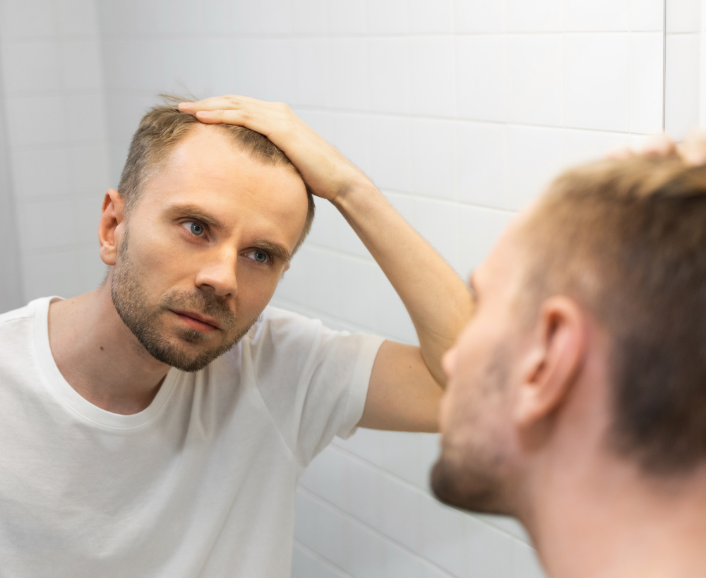 Does Nitric Oxide Help with Hair Loss? - N1o1 Nitric Oxide - Boost Your