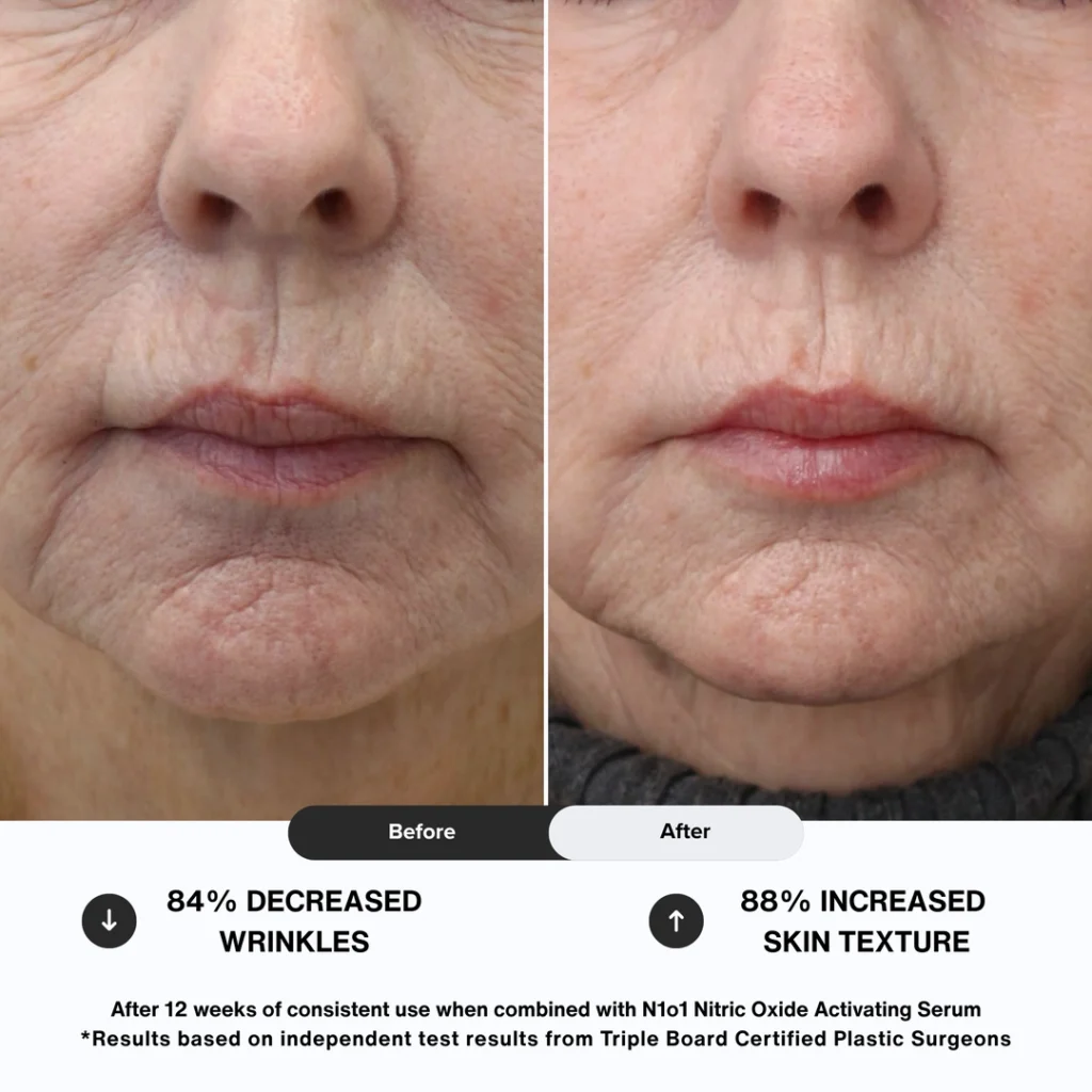 N1O1 nitric oxide nitric oxide signaling molecule