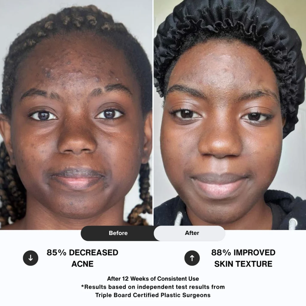 N1O1 nitric oxide nitric oxide nitric oxide signaling molecule