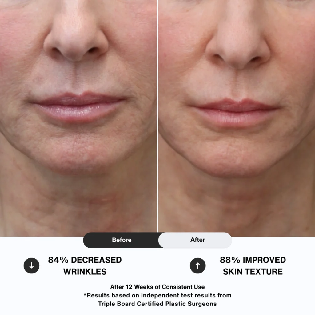 N1O1 nitric oxide nitric oxide nitric oxide signaling molecule