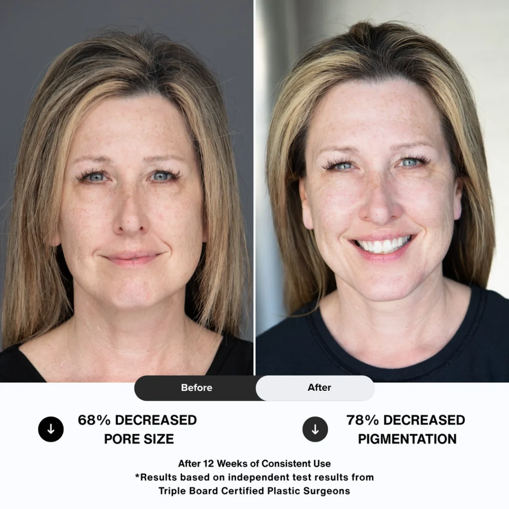 N1O1 nitric oxide nitric oxide nitric oxide signaling molecule