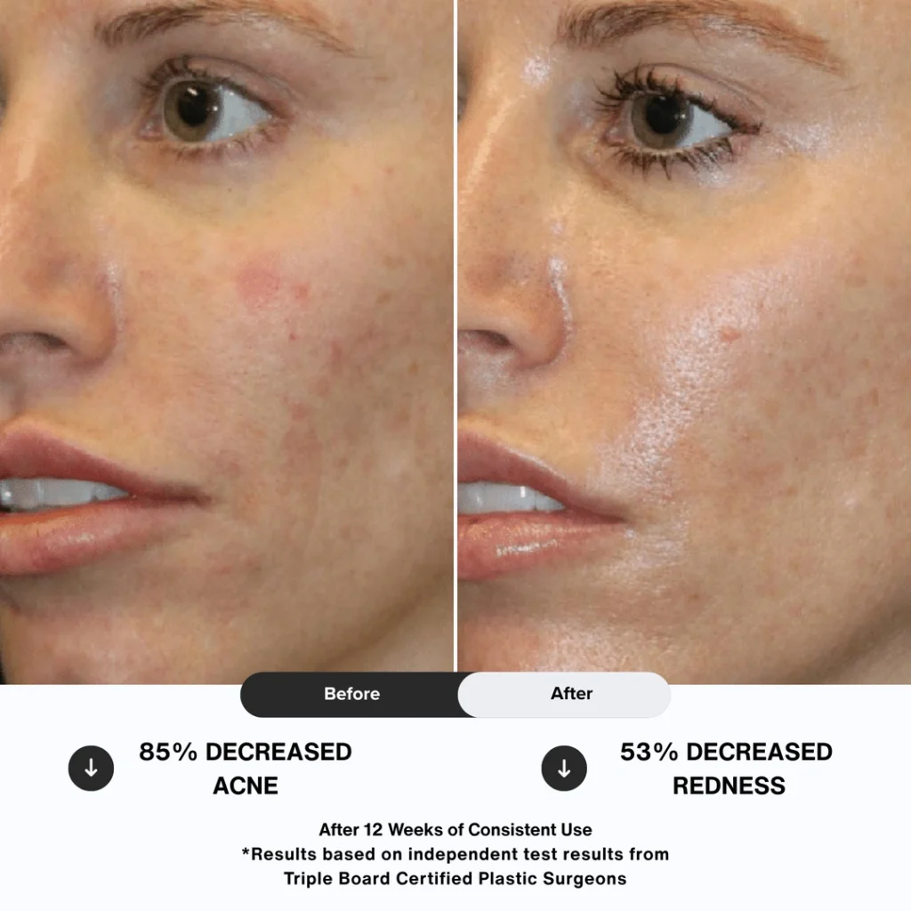 N1O1 nitric oxide nitric oxide nitric oxide signaling molecule