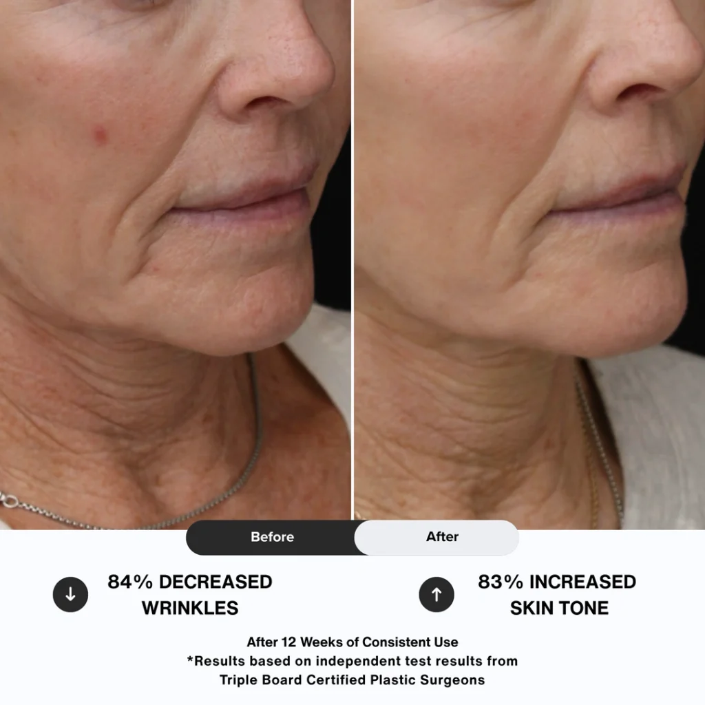 N1O1 nitric oxide nitric oxide nitric oxide signaling molecule